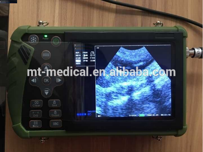 Ultrasonido portatil Ultrasonido personal laptop ultrasound Machine