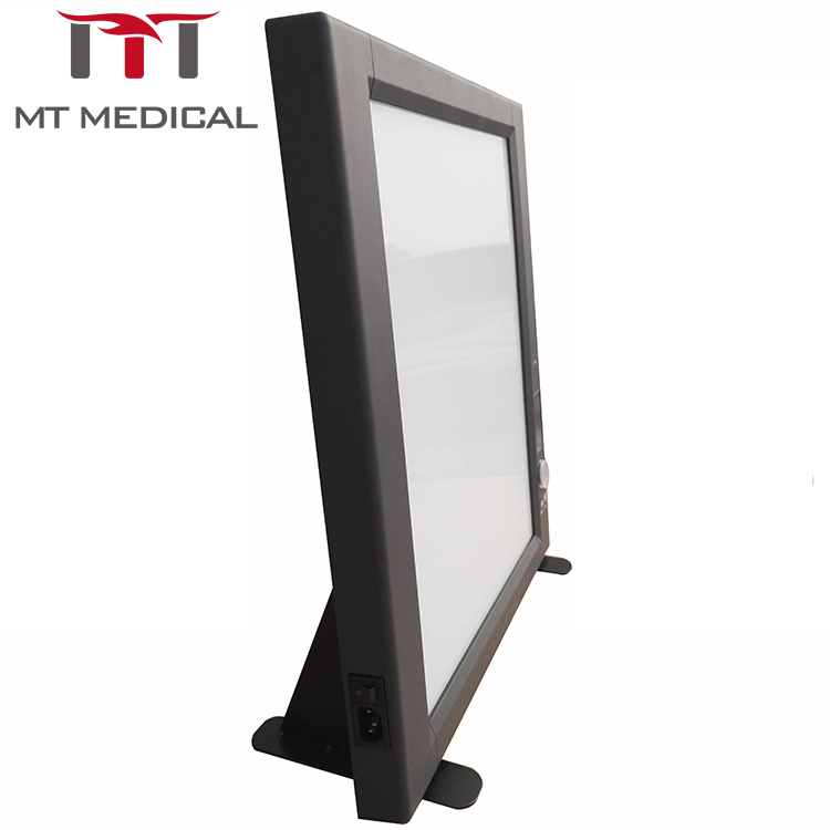 Hospital LED negatoscope triple x ray film view box 100ma x ray machine