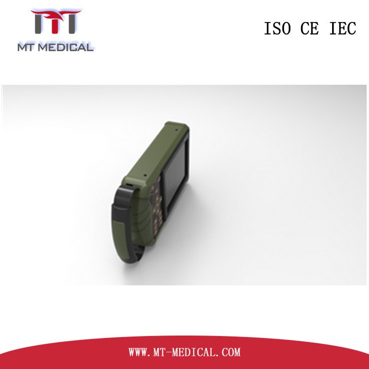 Best ultrasound Machine 4d laptop personal ultrasound Scanner