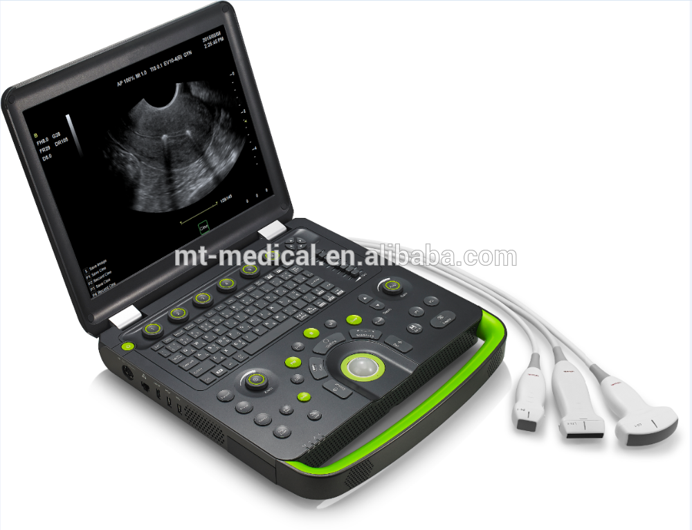 Medical Diagnostic Daul Probes Portable Ultrasound Scanner