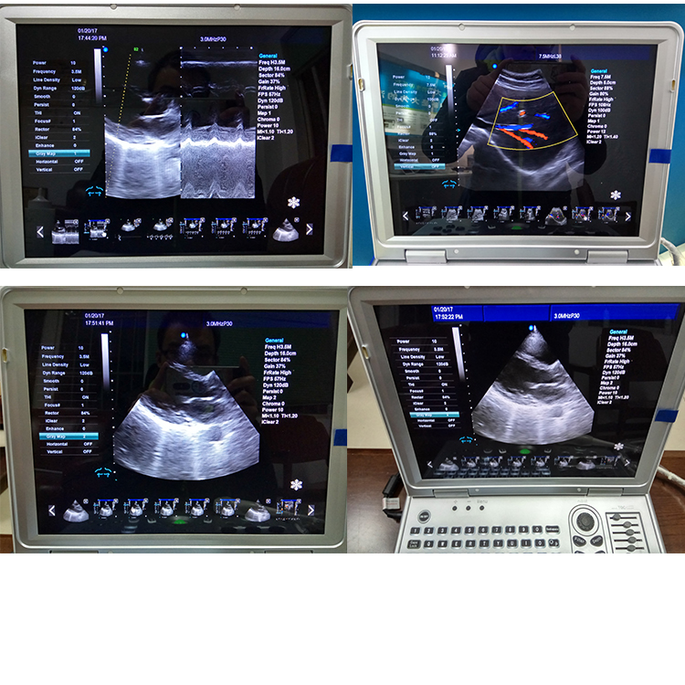 Ultrasound Diagnosing Equipment Doppler Color Scanner Price