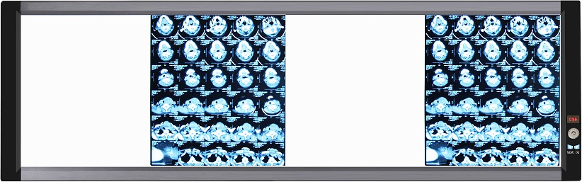 High quality LED X-ray viewer box for medical use, made in China