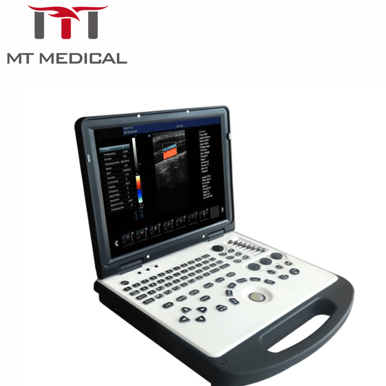 Doppler color Ultrasonido 4d ultrasound scanner PC laptop ultrasound scanner