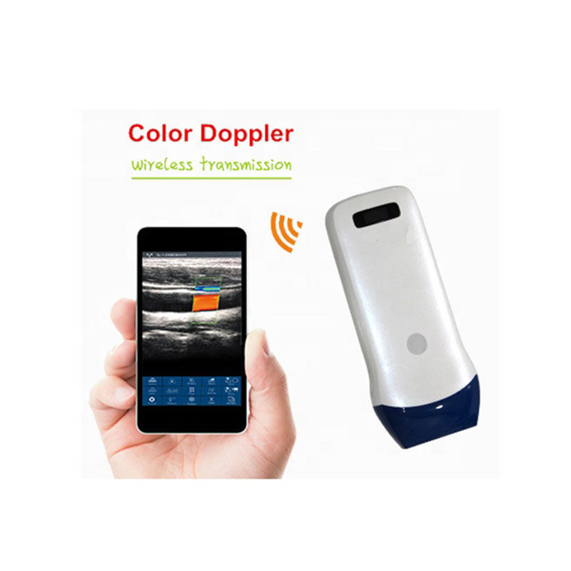 New Wifi Wireless Ultrasound Probe / Handheld Wireless Color Doppler Ultrasound Scanner