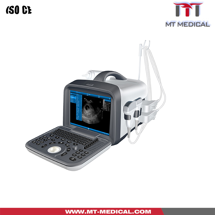 Cheapest Ultrasound Machine Portable Handy Scanner B Ultrasound Machine