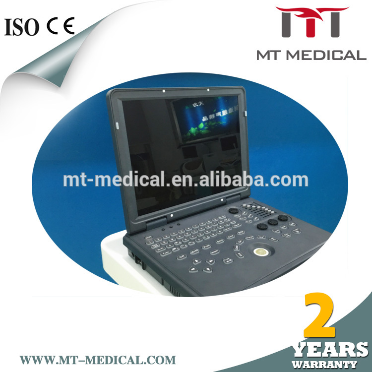 Dubai wholesale market 15-inch portable color doppler ultrasound machine