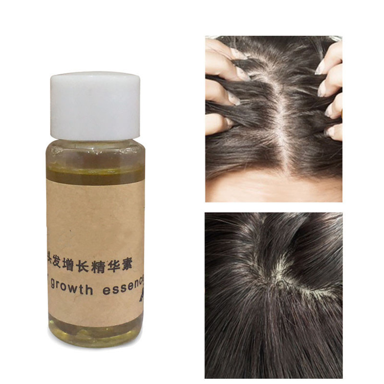 Fast Sunburst Growth Products Serum Hair Growth Essence Organic Coconut Argan Hair Oil Treatment