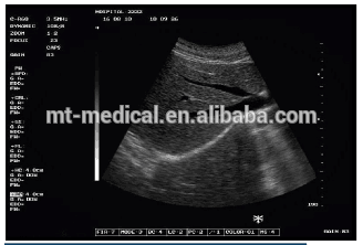 portable ultrasonic machine type 2d