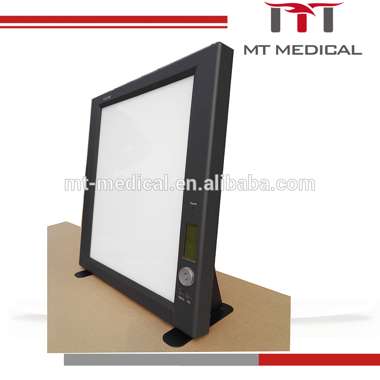 dental medical LED x-ray film viewer single