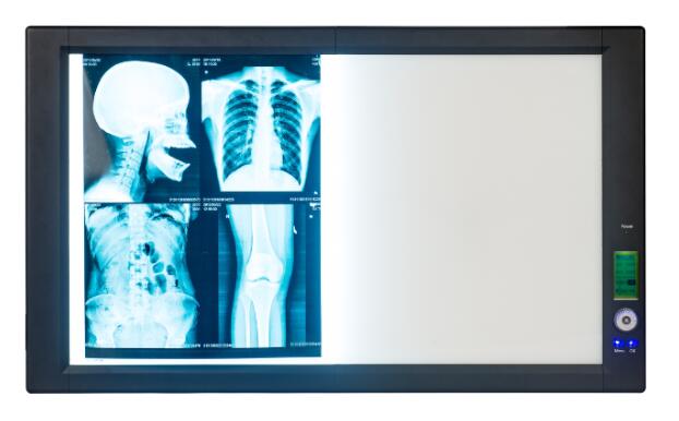x-ray film viewer led x-ray film light box medical led x ray negatoscope