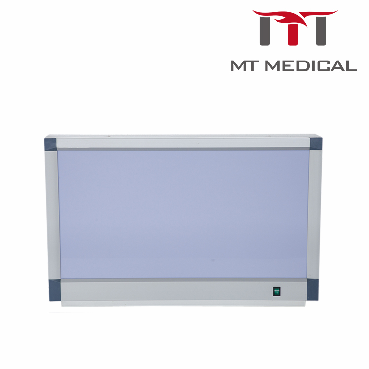 Negatoscope Double X-ray Film Viewer Price