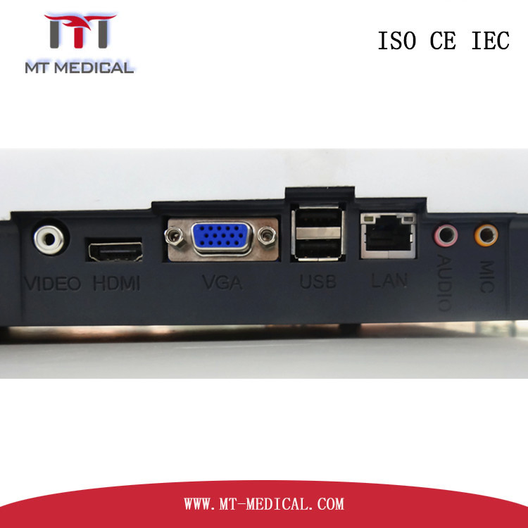 High Level 4D Color Ultrasound C-60 Portable ultrasound machine