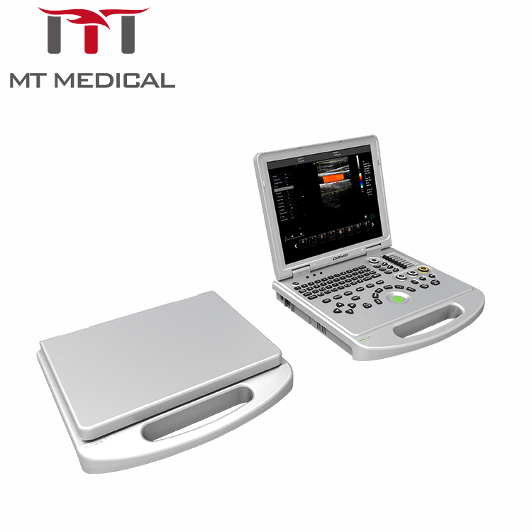 Laptop Doppler Ultrasound Portable Ultrasound Scanner