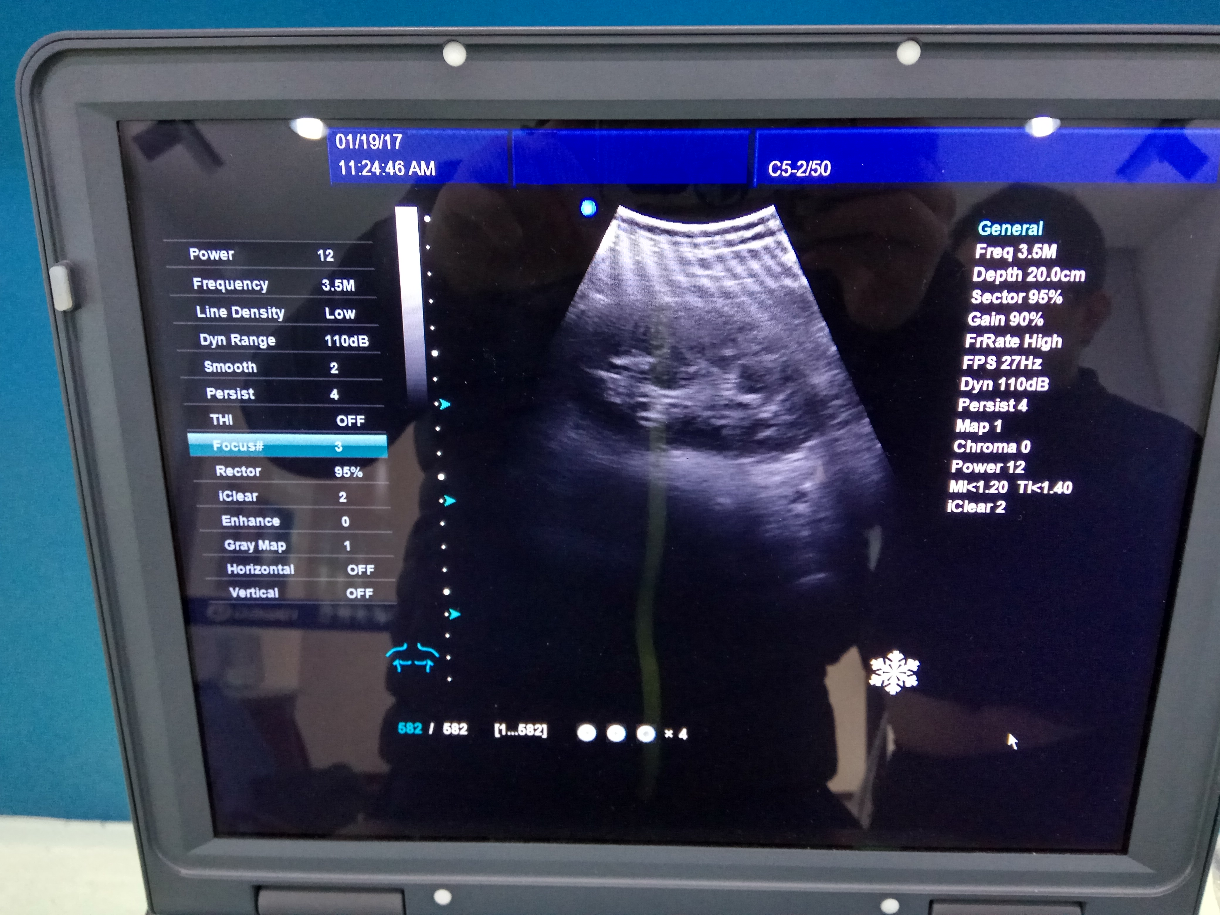 Portable 3D/4D color ultrasound machine price for gynecology