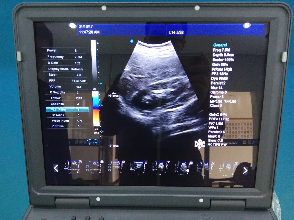 3d colour douppler ultrasound machine price laptop ultrasound machine portable