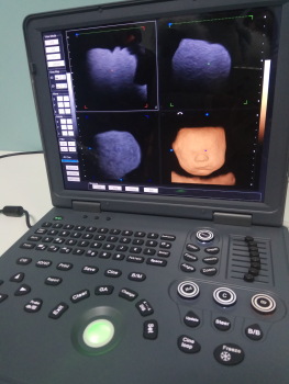 Multifunction portable color doppler ultrasound machine