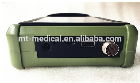 Ultrasonido portatil veteriner ultrasound personal laptop ultrasound Machine