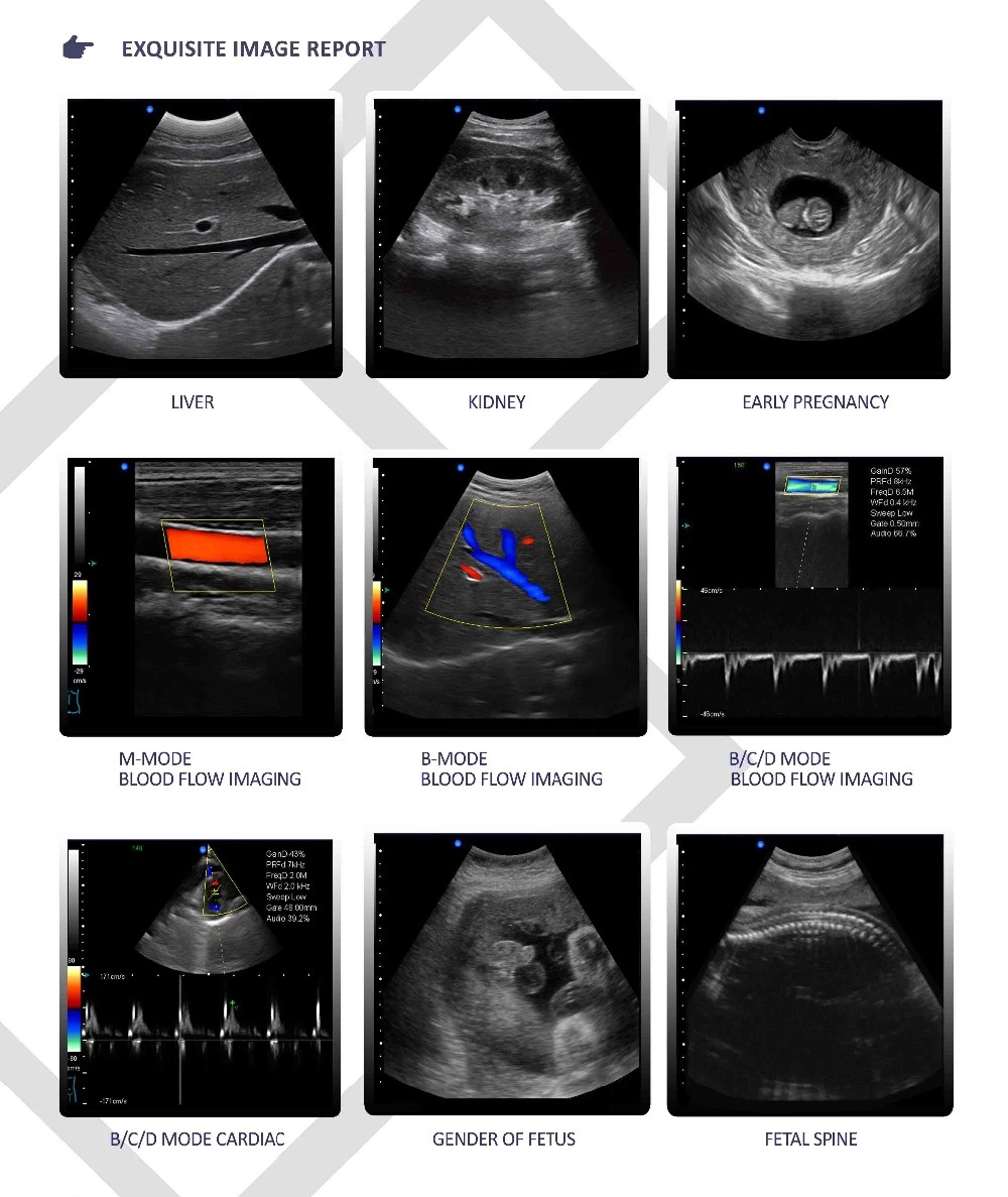 High Quality Ultrasound Scanner for C-60 plus with color machine