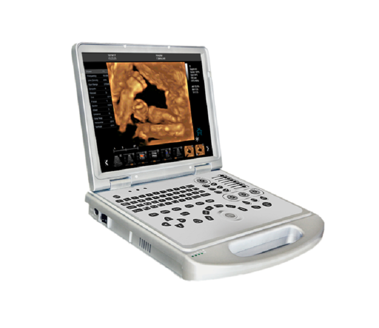 Portable diagnostic 3D/4D continous color doppler ultrasound machine