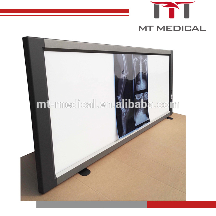 Medical LED Negatoscope Triple X-Ray Film Scanner