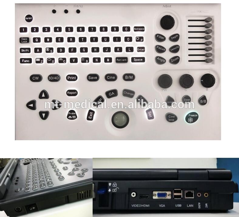 Promotion price laptop color doppler ultrasound Machine 3D 4D Color Doppler