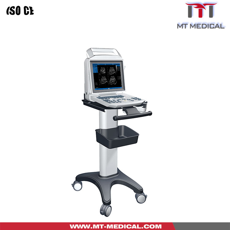 Black white Ultrasound Machine Cheap Ultrasound Machine B ultrasound Machine