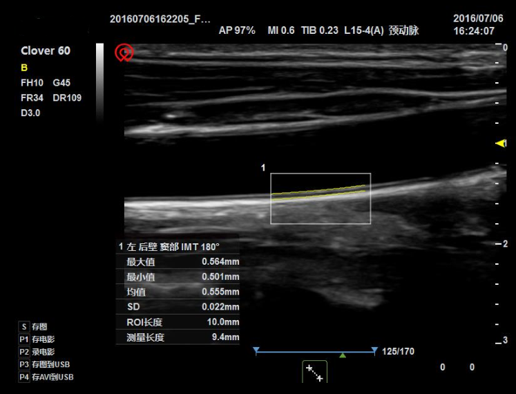 Medical Ultrasound More Than Two Probe Socket Portable Scanner