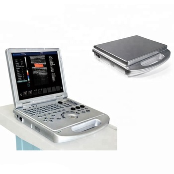 High-class Portable continuous doppler cardiac inspection 3d 4d echocardiograph