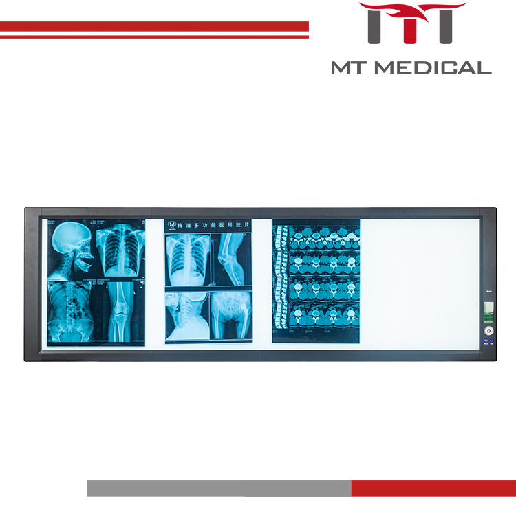 Most New models of ultrathin LED x-ray film viewer for public use and special for hospital