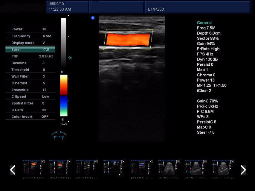 ABCF PBM-2 Veterinary Ultrasound Equipment, Prices Of Ultrasound Machine