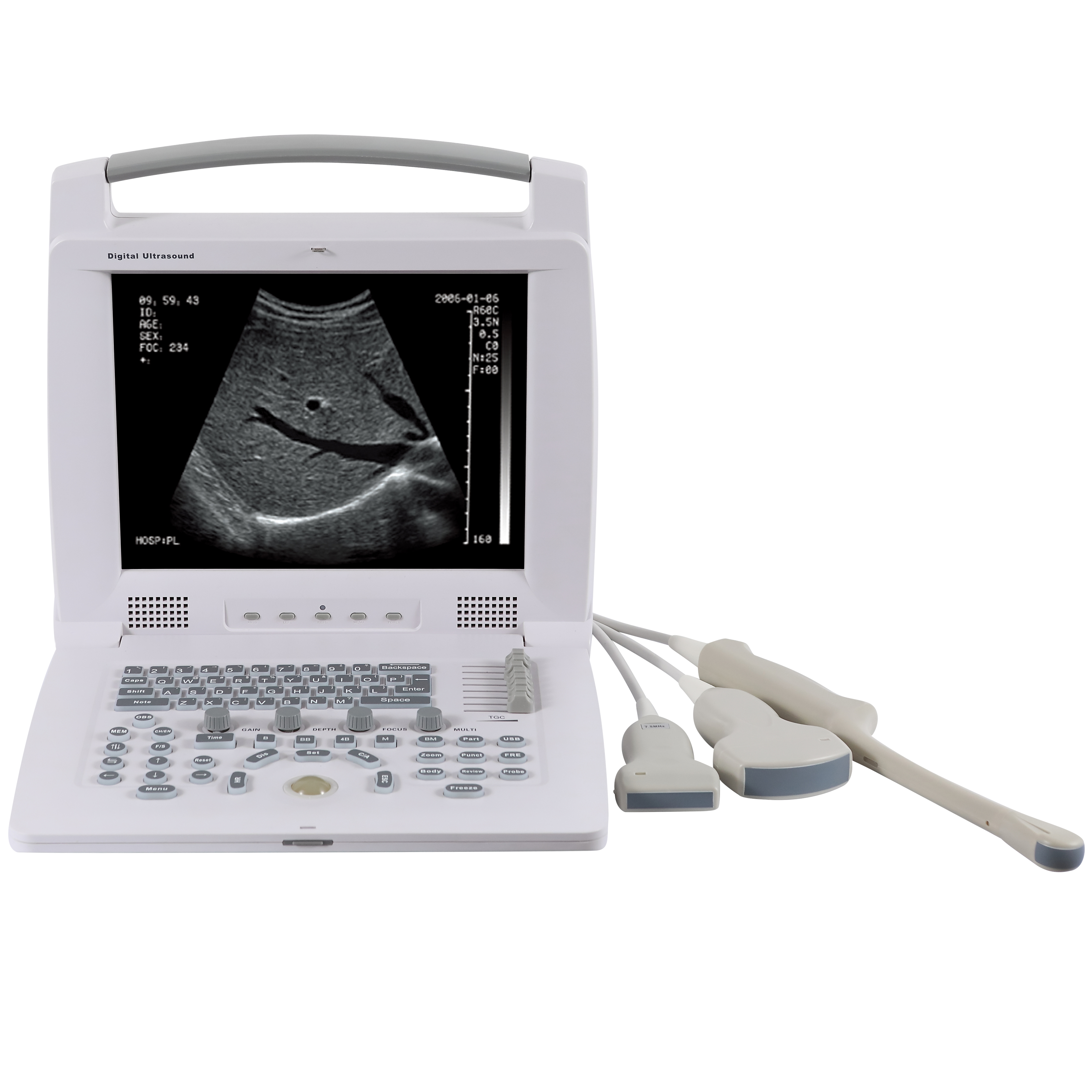 12.1 inch high resolution monitor portable vet B&W ultrasound scanner machine