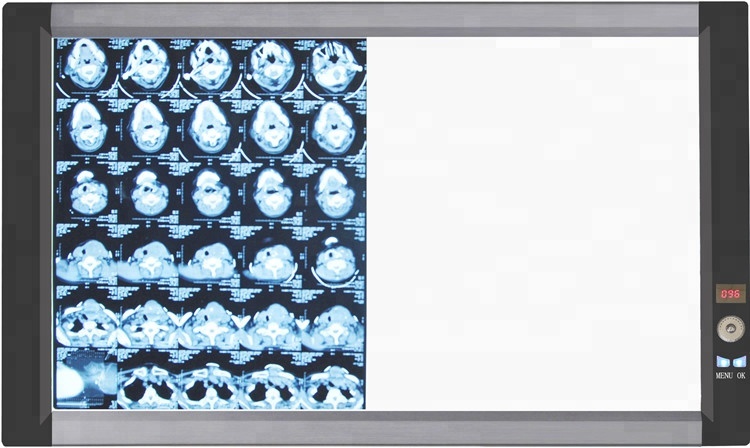 Super thin Quadruple LED x ray film viewing box negatoscope