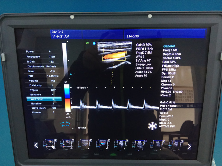 China made 3D/4D ultrasound scanner/machine price