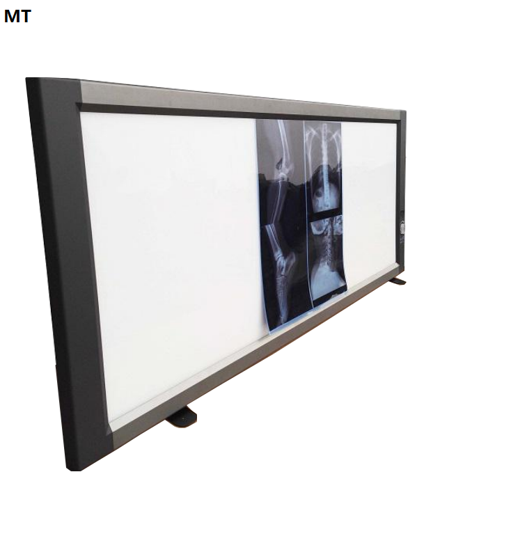 Portable Medical Led X Ray Negatoscope Triple Machine