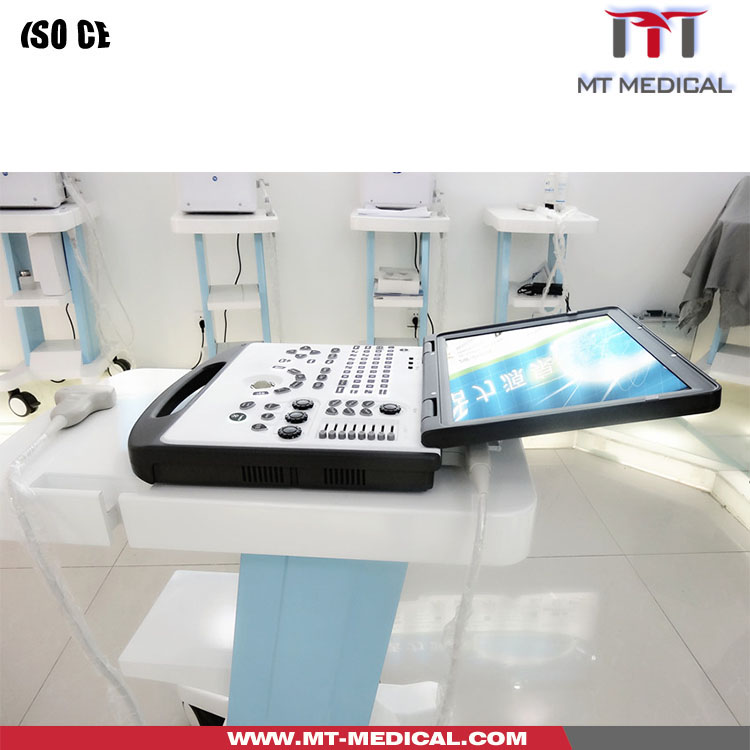 Portable 3D Doppler Ultrasound Machine Ultrasonography