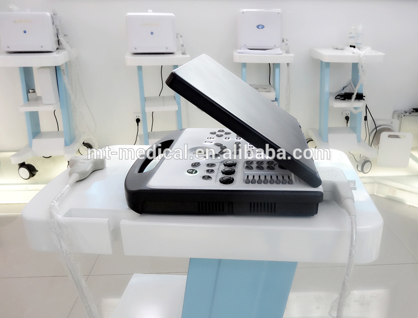 Hospital equipment portable Ultrasound machine Cheapest mini portable ultrasound machines