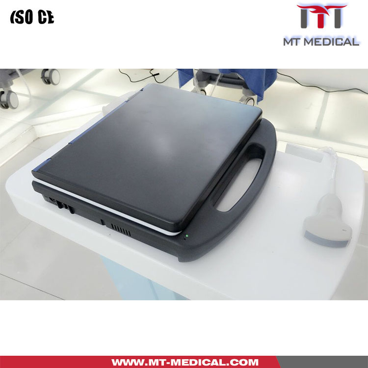 Laptop Color Doppler Ultrasound Machine Color Cheap ultrasound Machine