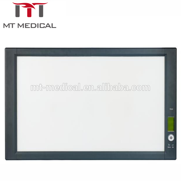 Most popular hospital medical equipment double LED x ray view box from China