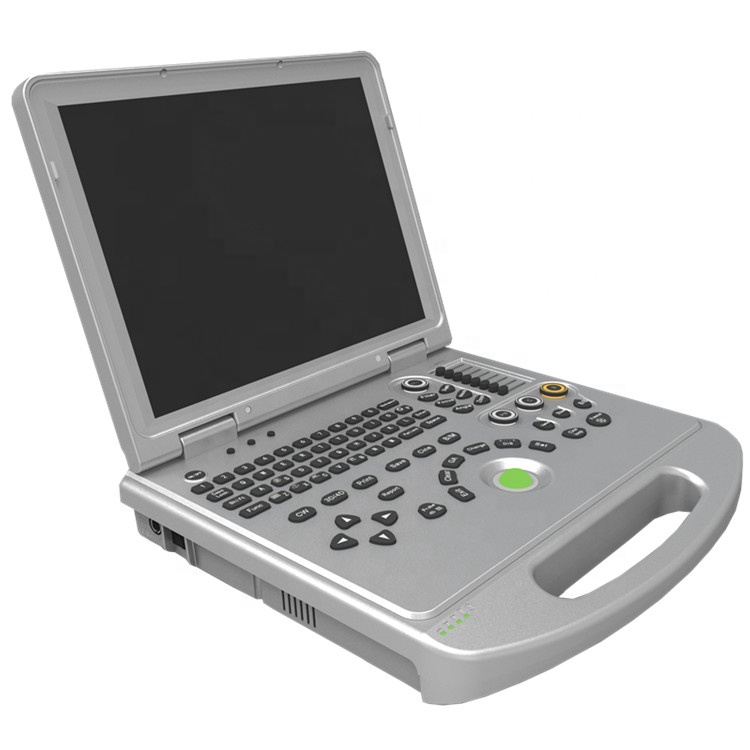 Portable 4D color doppler ultrasound device for cardiac