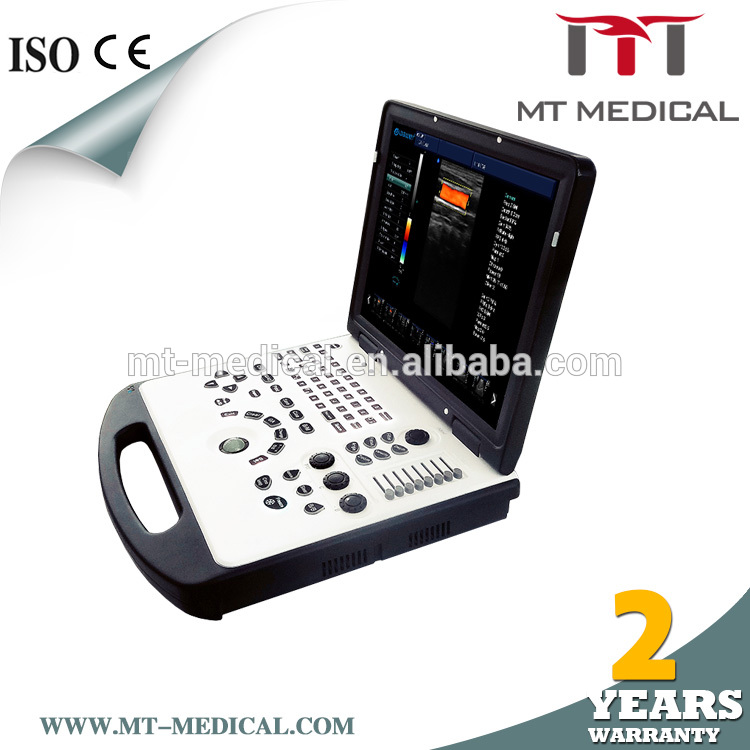 2018 Top selling products 15-inch portable doppler ultrasound machine