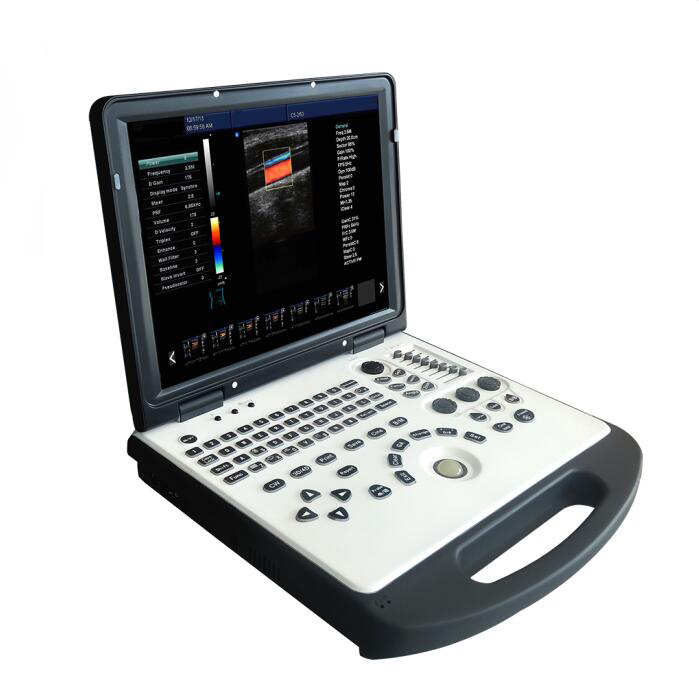 Full digital 4D portable Color Doppler ultrasound machine on sale with factory price
