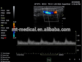 15inch LED Screen 3d/4d Laptop Ultrasonic scanner with Daul Probes for laptop computer