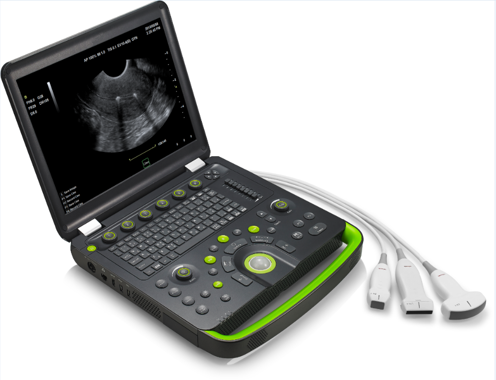 2017 New Portable Laptop Ultrasonic Diagnostic Devices Type ultrasound machine