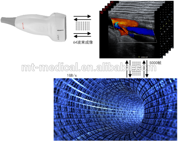 Double Probe Sockets Support Digital Portable Ultrasound Scanner Equipment