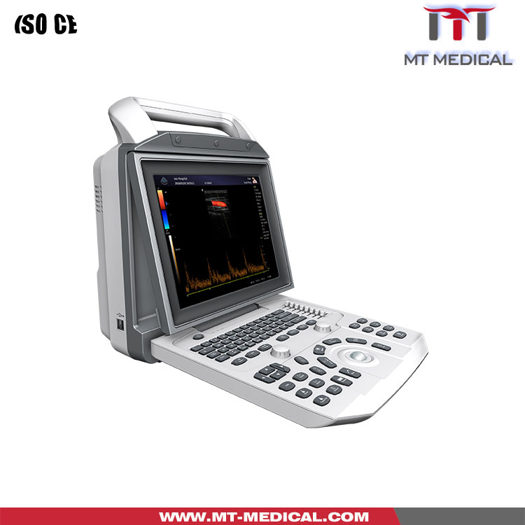 New medical equipment ultrasound product for hospital and clinic from China manufacture