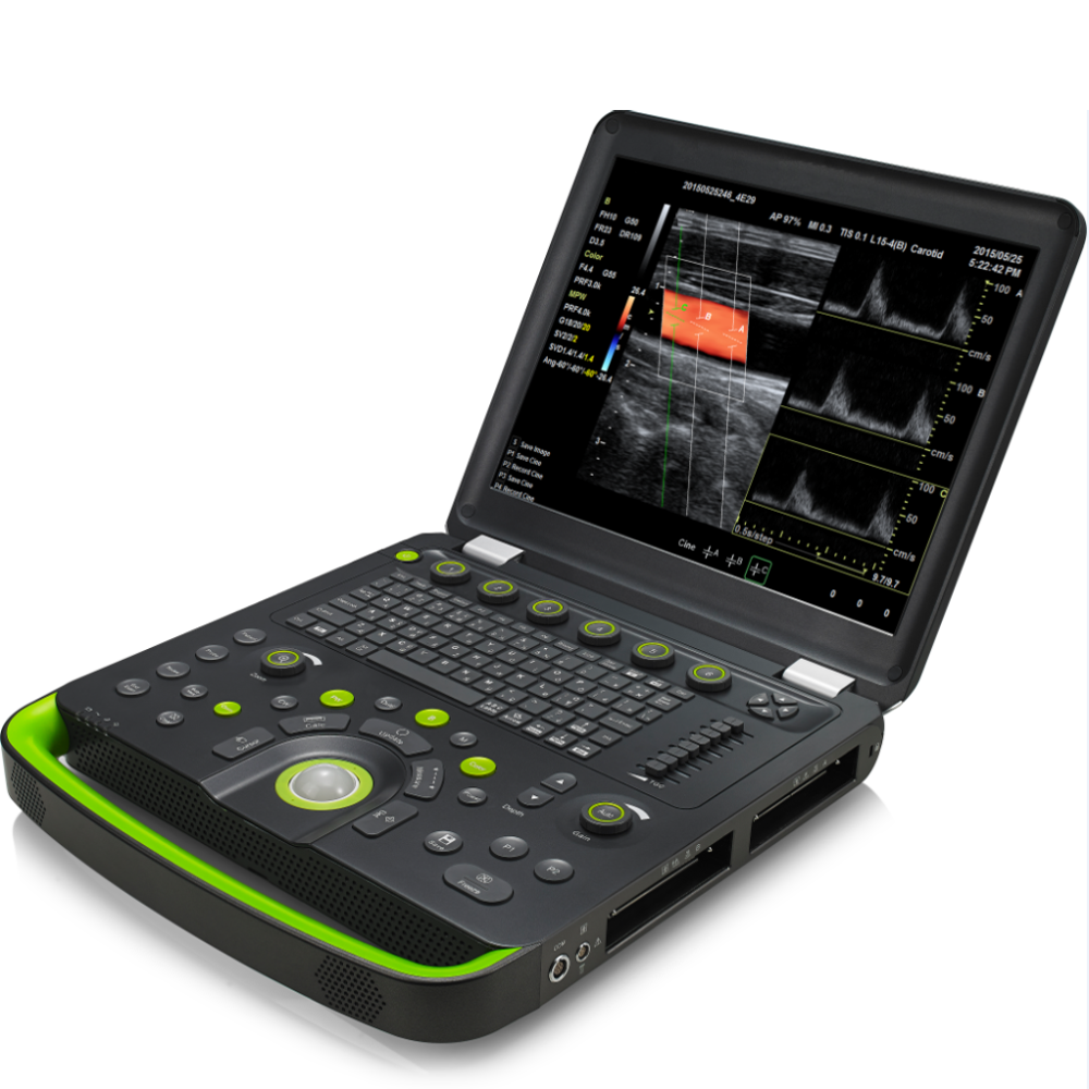 Ultrasound Cart Medical Equipment Portable Scanner