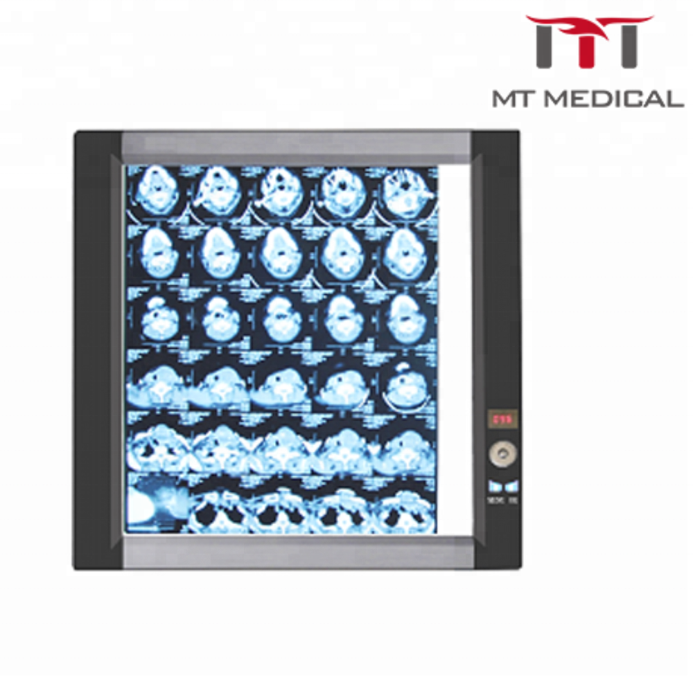 Medical Device Negatoscope Single X-ray Film Scanner