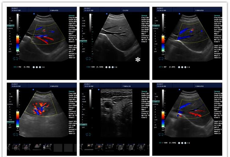 Best quality multifunction portable 3d color doppler ultrasound machine price