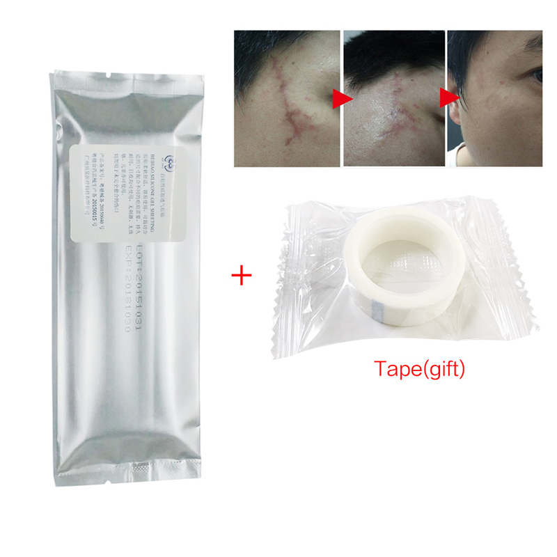 New Silicone Gel Scar Repair Sheeting Cesarean Section Surgery Removal Scar Sheet Therapy Patch For Acne Trauma