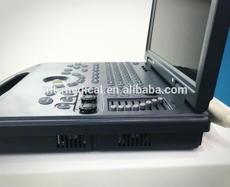 Laptop Ultrasound machine personal ultrasound machine laptop ultrasound scanner
